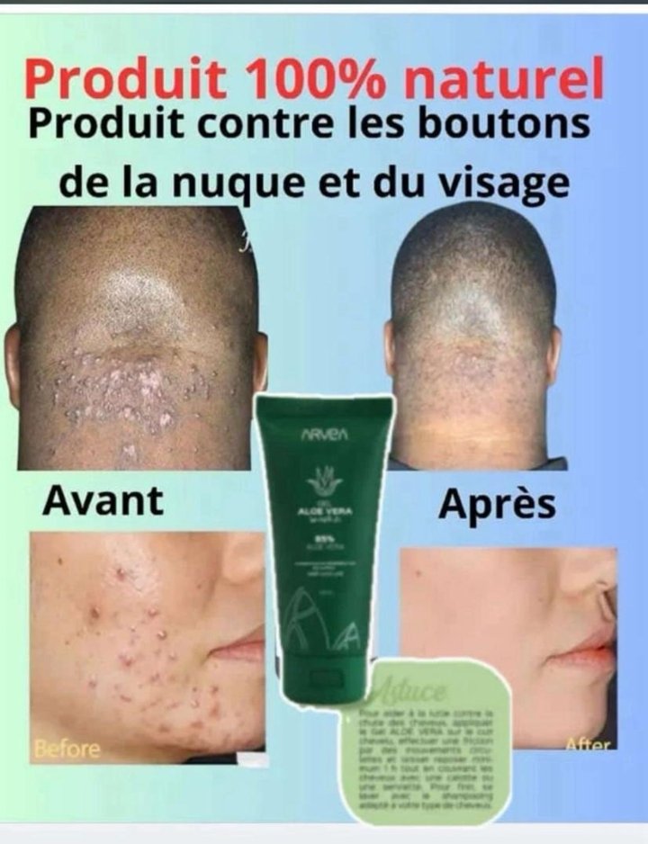 Gel Aloé Vera 95% ARVEA