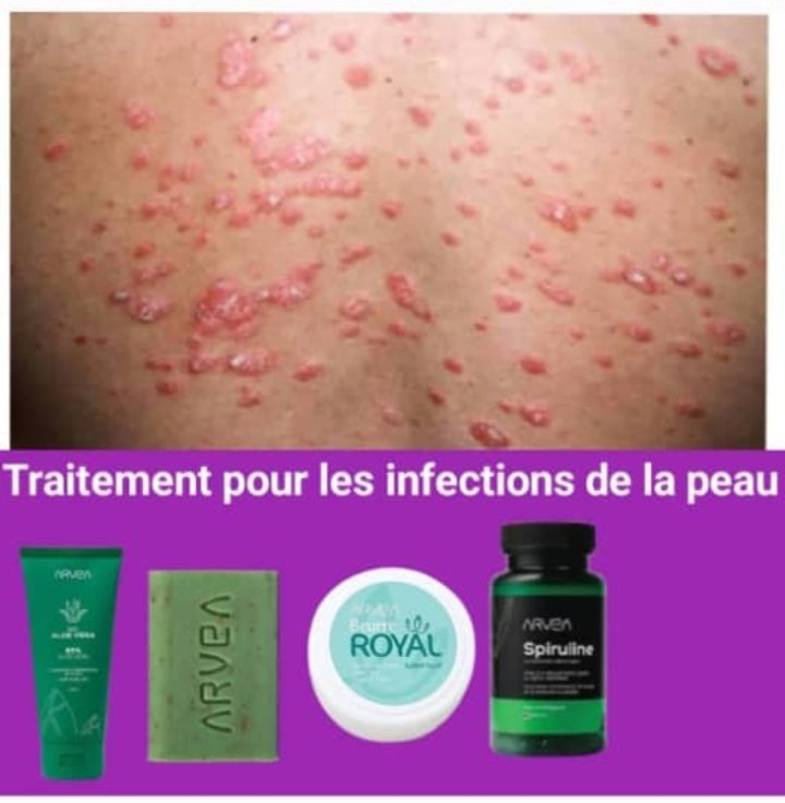 Gel Traitement Nuque